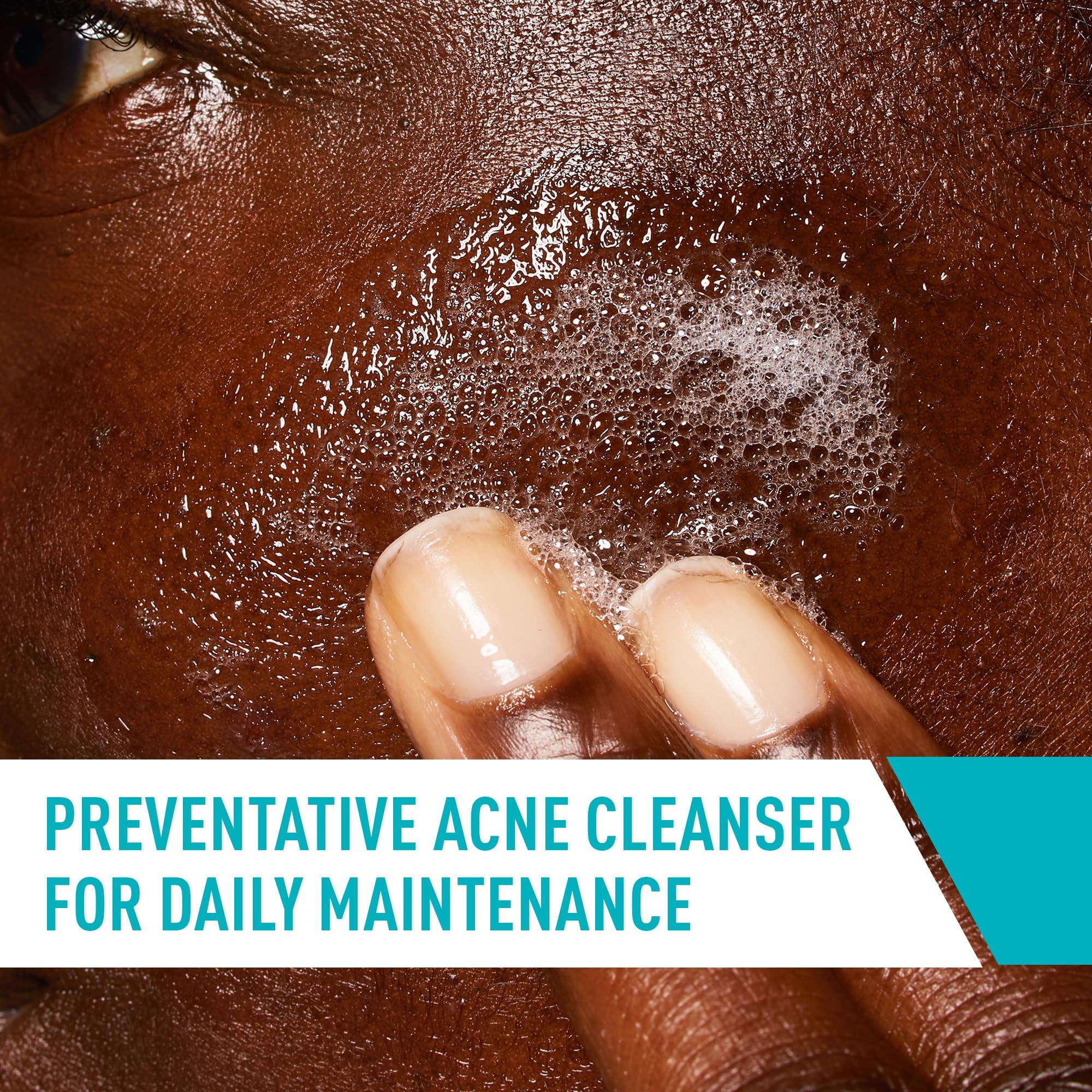 CeraVe Acne Treatment Face Wash, Salicylic Acid Cleanser with Purifying Clay, Niacinamide, and Ceramides, Pore Control and Blackhead Remover, 8 Ounce - Image 4