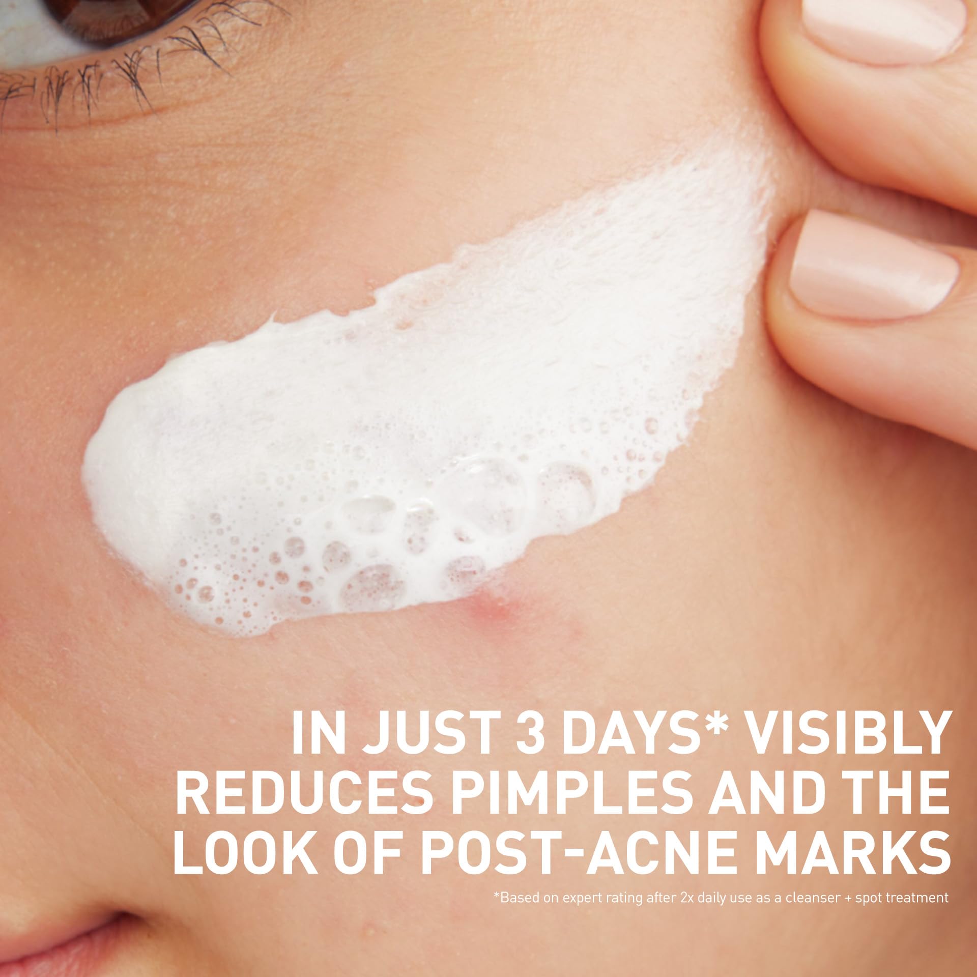 CeraVe Clay To Foam Acne Face Wash, Multi-Use Salicylic Acid & Kaolin Clay Acne Spot Treatment Clears Pimples & Blackheads, Prevents Breakouts, Hydrates & Soothes, Fragrance-Free, Non-Comedogenic, 4oz - Image 3
